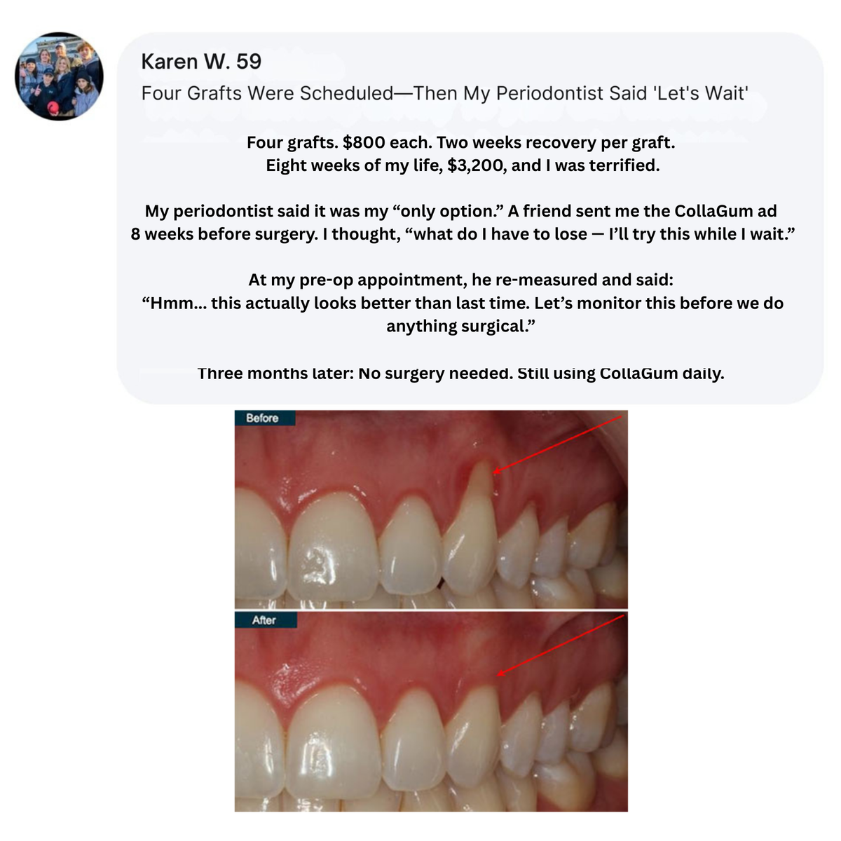 Gum Renewal Powder