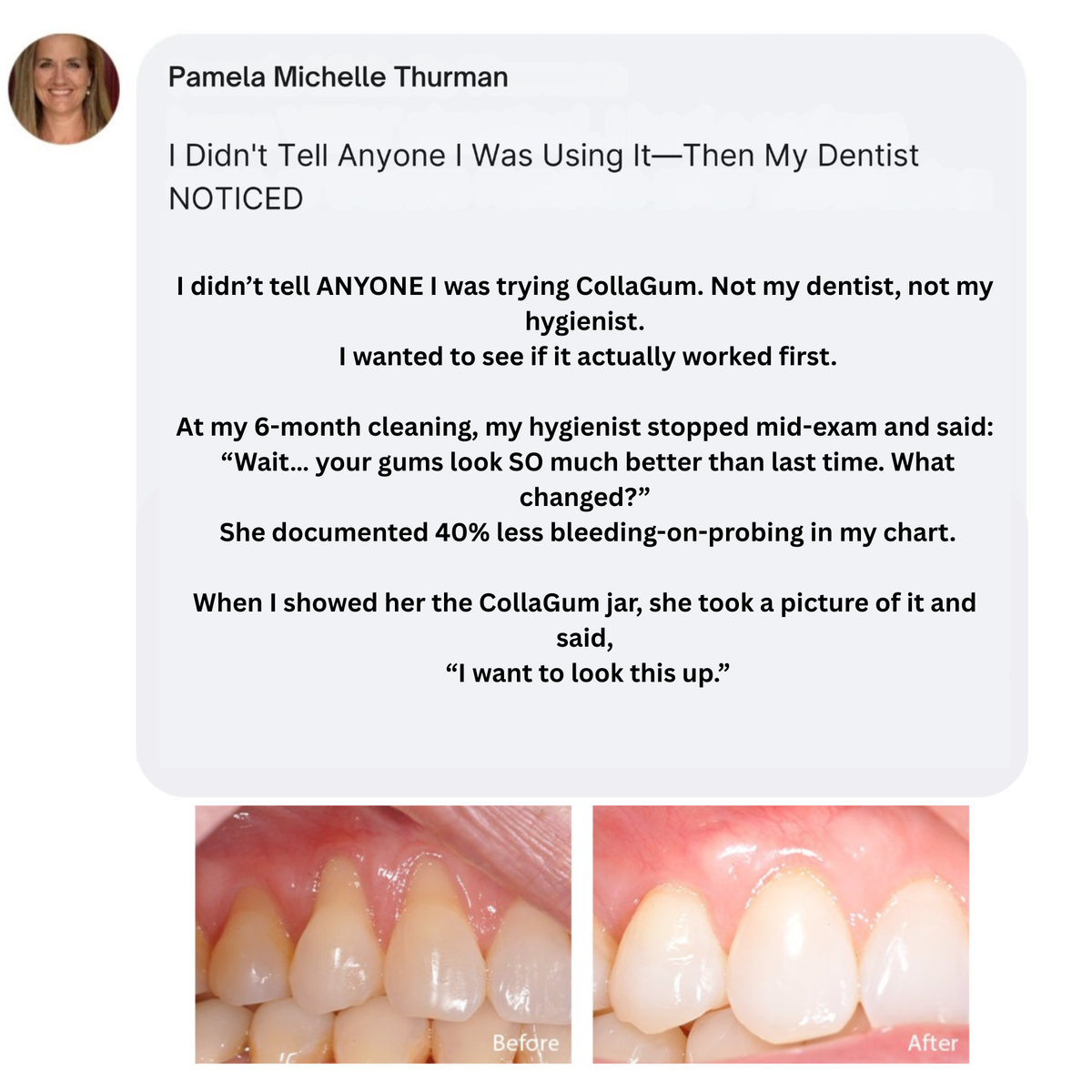 Gum Renewal Powder