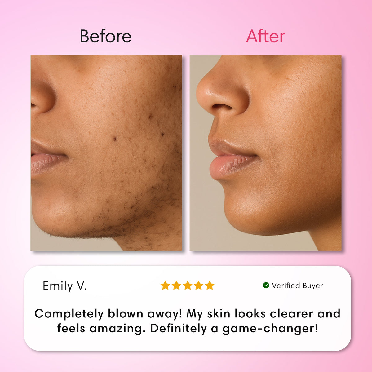 Facial Hair Removal Trio Kit