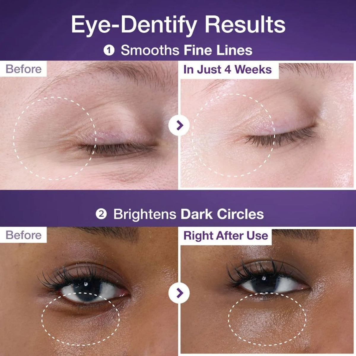 NAD+ Retinol Eye Cream